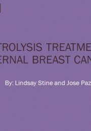 Electrolysis Treatment in Breast Cancer